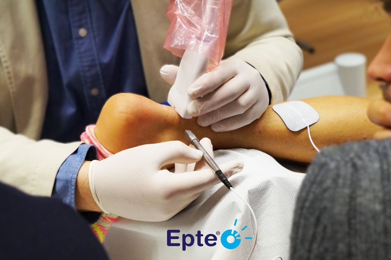 Διαδερμική ηλεκτρόλυση - EPTE, μια ελάχιστα επεμβατική ορθοπαιδική μέθοδο θεραπείας