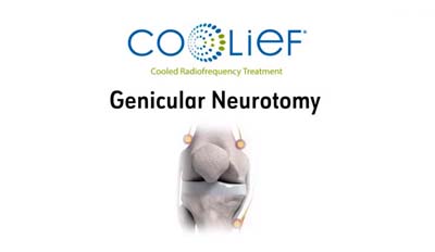 coolief neurotomy