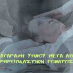 Διαταραχή ύπνου μετά από αρθροπλαστική γόνατος