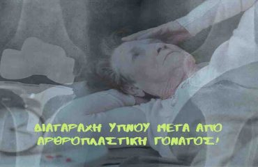 Sleep TKA FB1 Διαταραχή ύπνου μετά από αρθροπλαστική γόνατος