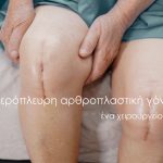 αμφίπλευρη αρθροπλαστική γόνατος
