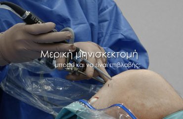 μερική μηνισκεκτομή