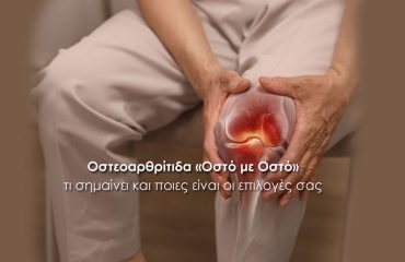 Οστεοαρθρίτιδα «Οστό με Οστό»